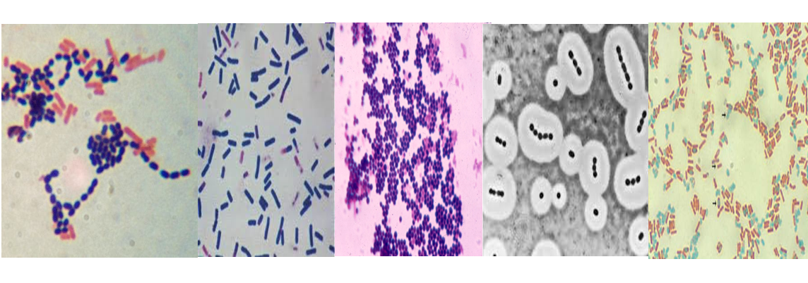 Describe la morfología y estructura de las bacterias