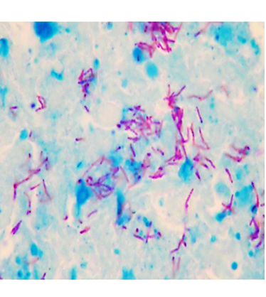 Describe la morfología y estructura de las bacterias