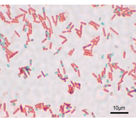 Describe la morfología y estructura de las bacterias