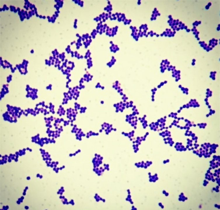 Describe la morfología y estructura de las bacterias