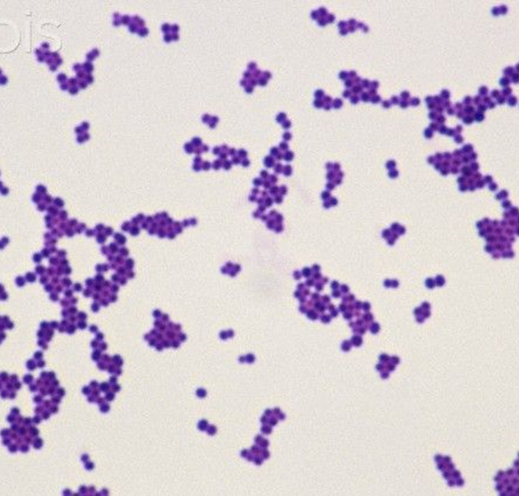 Describe la morfología y estructura de las bacterias