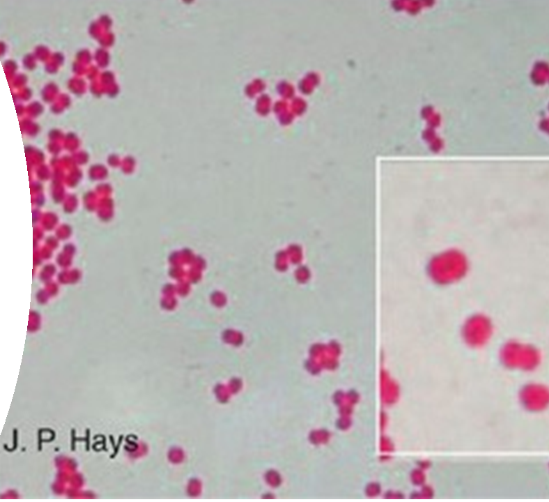 Describe la morfología y estructura de las bacterias