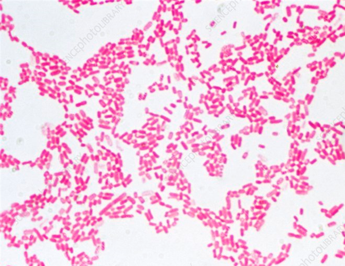Describe la morfología y estructura de las bacterias