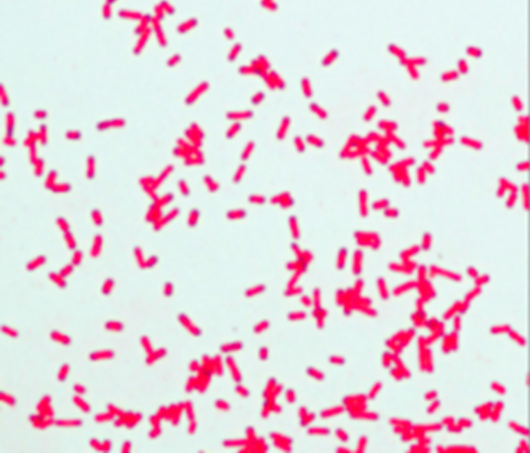 Describe la morfología y estructura de las bacterias