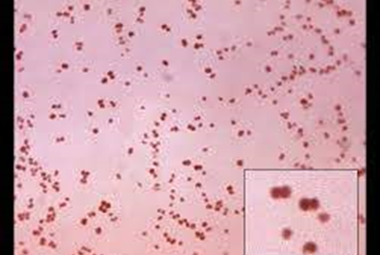 Describe la morfología y estructura de las bacterias