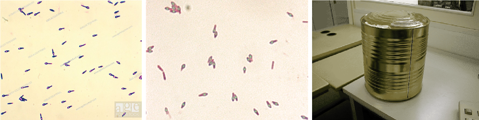 Describe la morfología y estructura de las bacterias