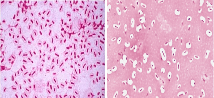 Describe la morfología y estructura de las bacterias