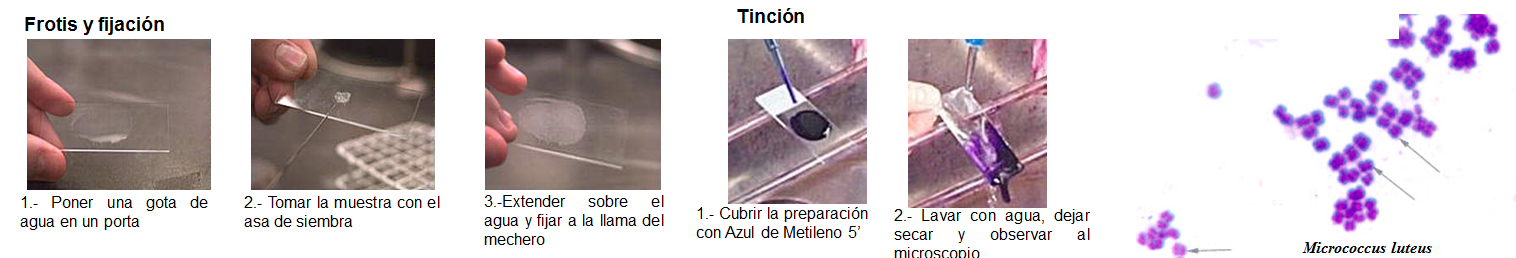 Conoce la aplicación de las coloraciones bacterianas y métodos de esterilización.