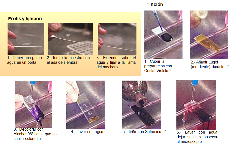 Conoce la aplicación de las coloraciones bacterianas y métodos de esterilización.