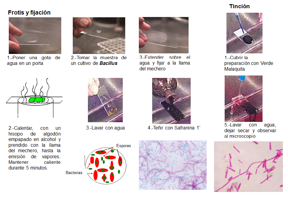Conoce la aplicación de las coloraciones bacterianas y métodos de esterilización.