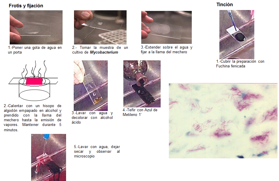 Conoce la aplicación de las coloraciones bacterianas y métodos de esterilización.