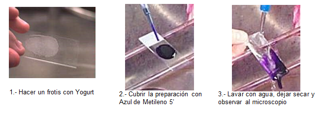 Conoce la aplicación de las coloraciones bacterianas y métodos de esterilización.