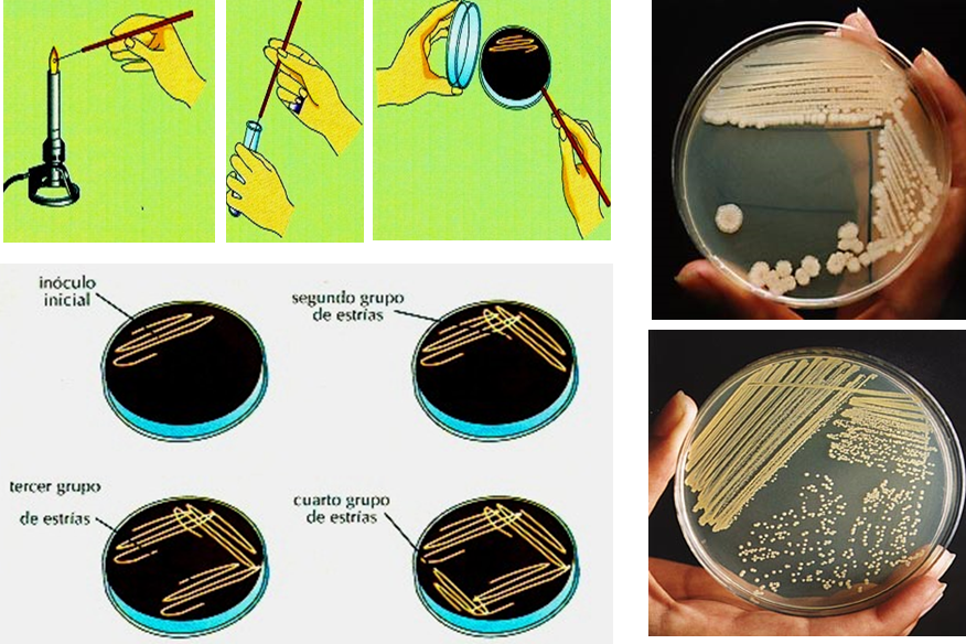 Conoce la aplicación de las coloraciones bacterianas y métodos de esterilización.