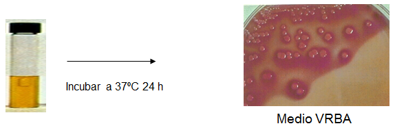 Conoce la aplicación de las coloraciones bacterianas y métodos de esterilización.