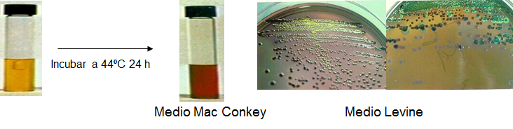 Conoce la aplicación de las coloraciones bacterianas y métodos de esterilización.