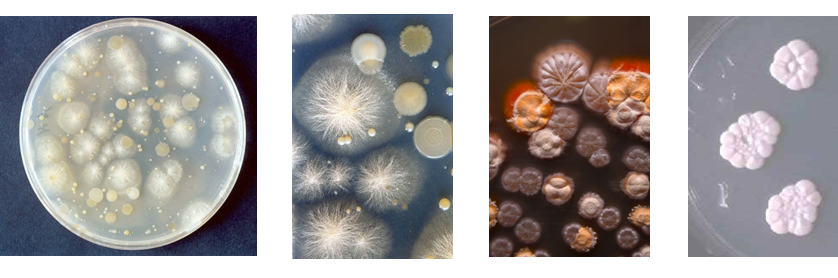 Conoce la aplicación de las coloraciones bacterianas y métodos de esterilización.
