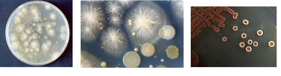 Conoce la aplicación de las coloraciones bacterianas y métodos de esterilización.