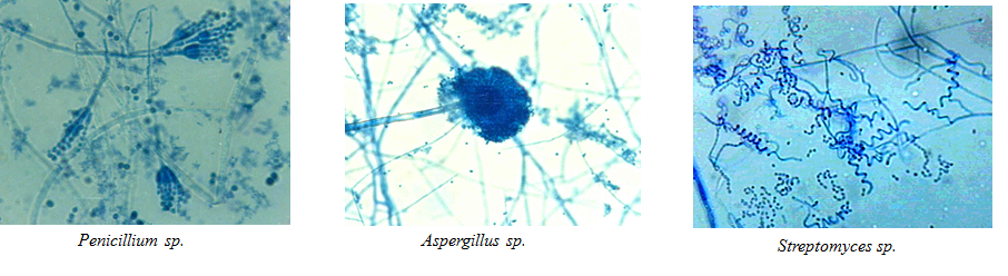 Conoce la aplicación de las coloraciones bacterianas y métodos de esterilización.