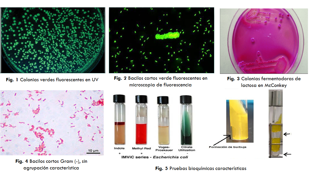 Comprende la genética microbiana