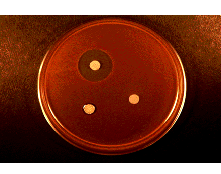 Comprende y conoce el crecimiento microbiano