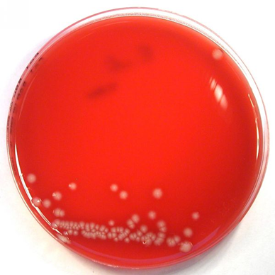 Describe las características, patogenicidad, vías de transmisión y prevención. Enterobacterias, Clostridium y Bacillus.
