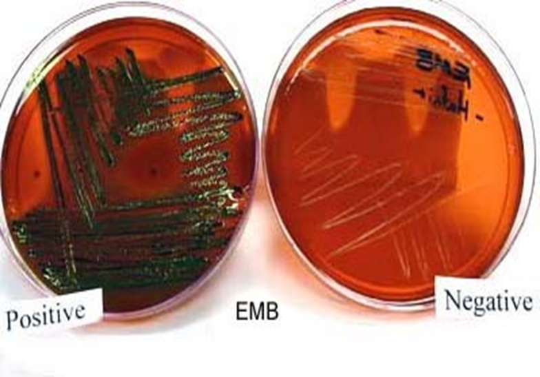 Describe las características, patogenicidad, vías de transmisión y prevención. Enterobacterias, Clostridium y Bacillus.