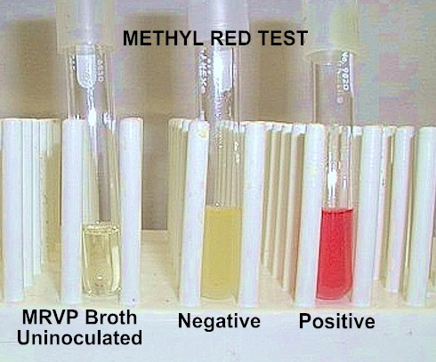 Describe las características, patogenicidad, vías de transmisión y prevención. Enterobacterias, Clostridium y Bacillus.