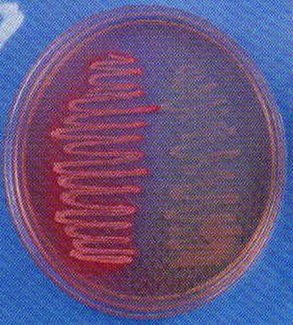 Describe las características, patogenicidad, vías de transmisión y prevención. Enterobacterias, Clostridium y Bacillus.