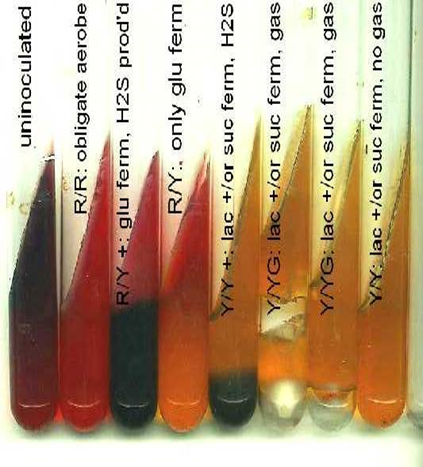 Describe las características, patogenicidad, vías de transmisión y prevención. Enterobacterias, Clostridium y Bacillus.