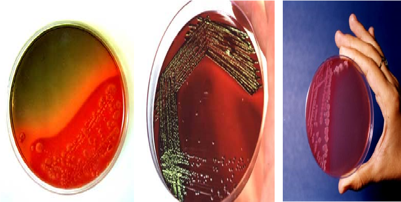 Describe las características, patogenicidad, vías de transmisión y prevención. Enterobacterias, Clostridium y Bacillus.