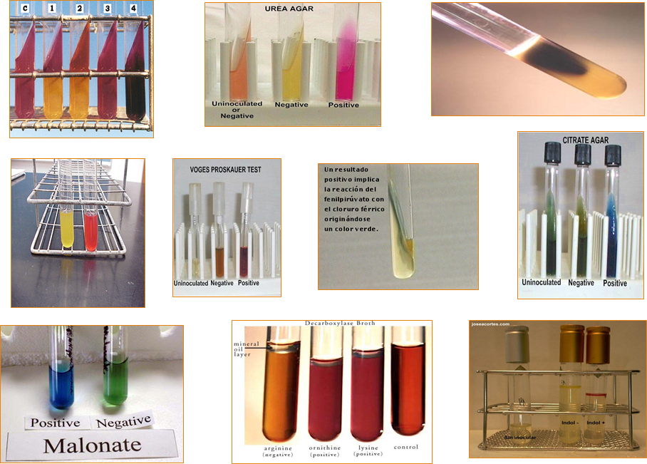 Describe las características, patogenicidad, vías de transmisión y prevención. Enterobacterias, Clostridium y Bacillus.