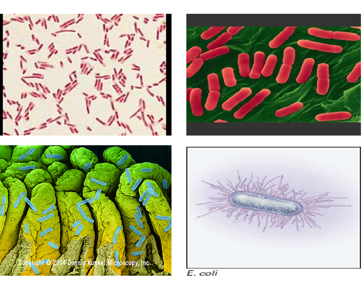 Describe las características, patogenicidad, vías de transmisión y prevención. Enterobacterias, Clostridium y Bacillus.