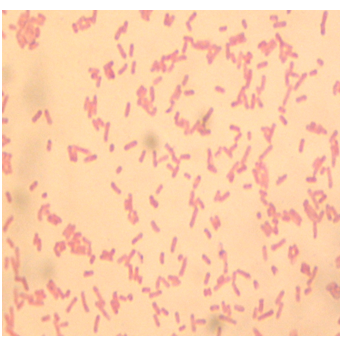 Describe las características, patogenicidad, vías de transmisión y prevención. Enterobacterias, Clostridium y Bacillus.