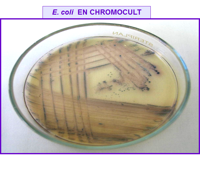 Describe las características, patogenicidad, vías de transmisión y prevención. Enterobacterias, Clostridium y Bacillus.