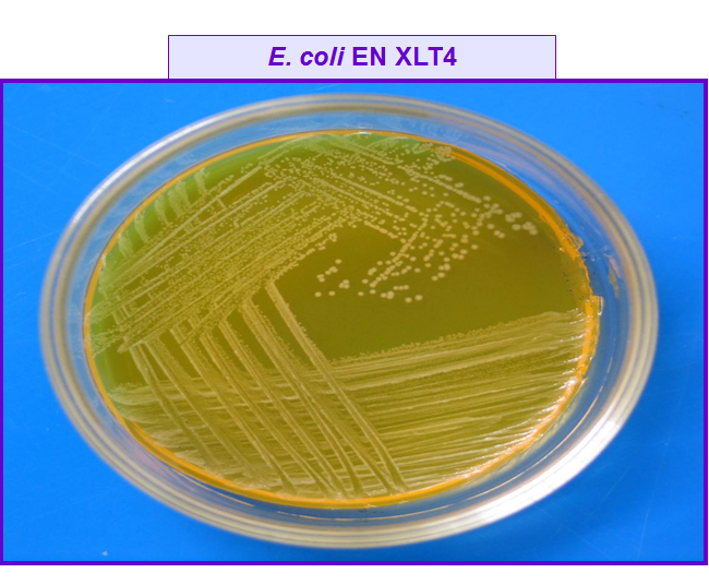 Describe las características, patogenicidad, vías de transmisión y prevención. Enterobacterias, Clostridium y Bacillus.