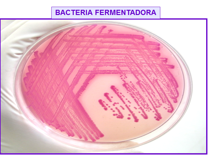 Describe las características, patogenicidad, vías de transmisión y prevención. Enterobacterias, Clostridium y Bacillus.