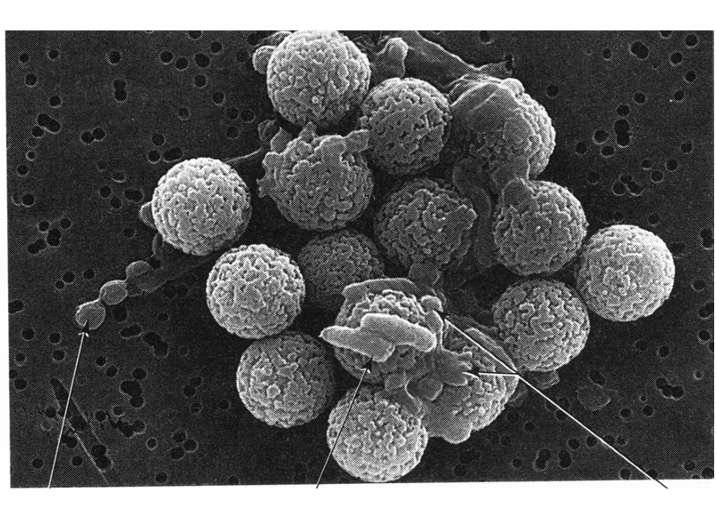 Describe las características, patogenicidad, vías de transmisión y prevención. Vibrio, Brucella, Pseudomona y Listeria.