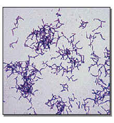 Describe las características, patogenicidad, vías de transmisión y prevención. Vibrio, Brucella, Pseudomona y Listeria.