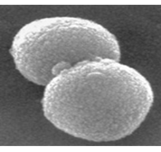 Describe las características, patogenicidad, vías de transmisión y prevención. Vibrio, Brucella, Pseudomona y Listeria.