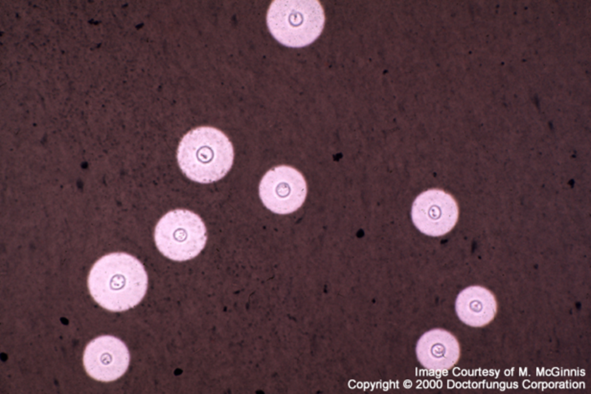 Describe las características, patogenicidad, vías de transmisión y prevención. Vibrio, Brucella, Pseudomona y Listeria.