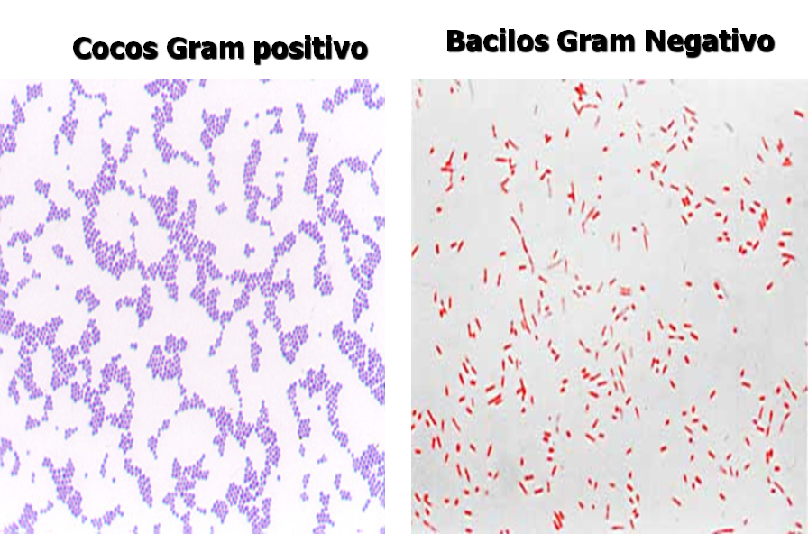 Describe las características, patogenicidad, vías de transmisión y prevención. Vibrio, Brucella, Pseudomona y Listeria.
