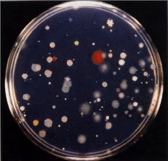 Campylobacter, Yersinia y Helicobacter pylori.