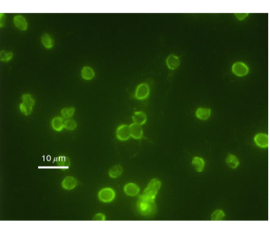 Campylobacter, Yersinia y Helicobacter pylori.