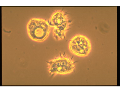 Campylobacter, Yersinia y Helicobacter pylori.