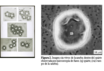 Campylobacter, Yersinia y Helicobacter pylori.