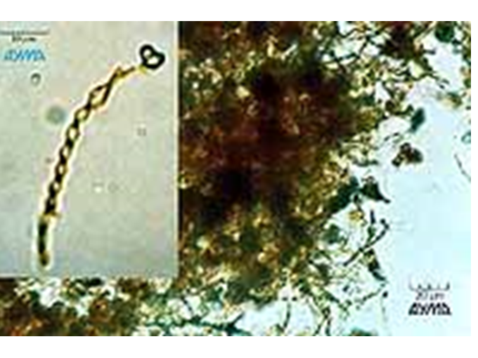 Campylobacter, Yersinia y Helicobacter pylori.