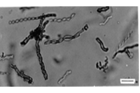 Campylobacter, Yersinia y Helicobacter pylori.