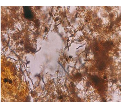 Campylobacter, Yersinia y Helicobacter pylori.