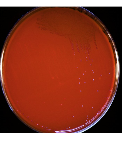 Describe las características, patogenicidad, vías de transmisión y prevención. Staphylococcus y Streptococcus.