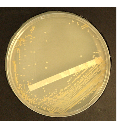 Describe las características, patogenicidad, vías de transmisión y prevención. Staphylococcus y Streptococcus.